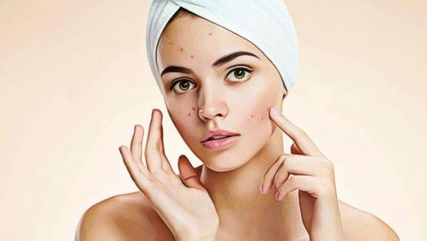 acne treatment - lifestan